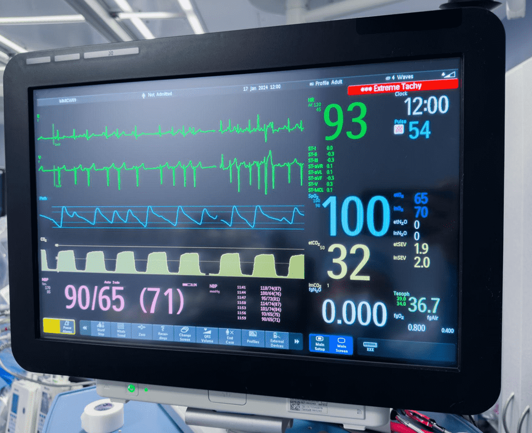 Patient Monitoring Systems